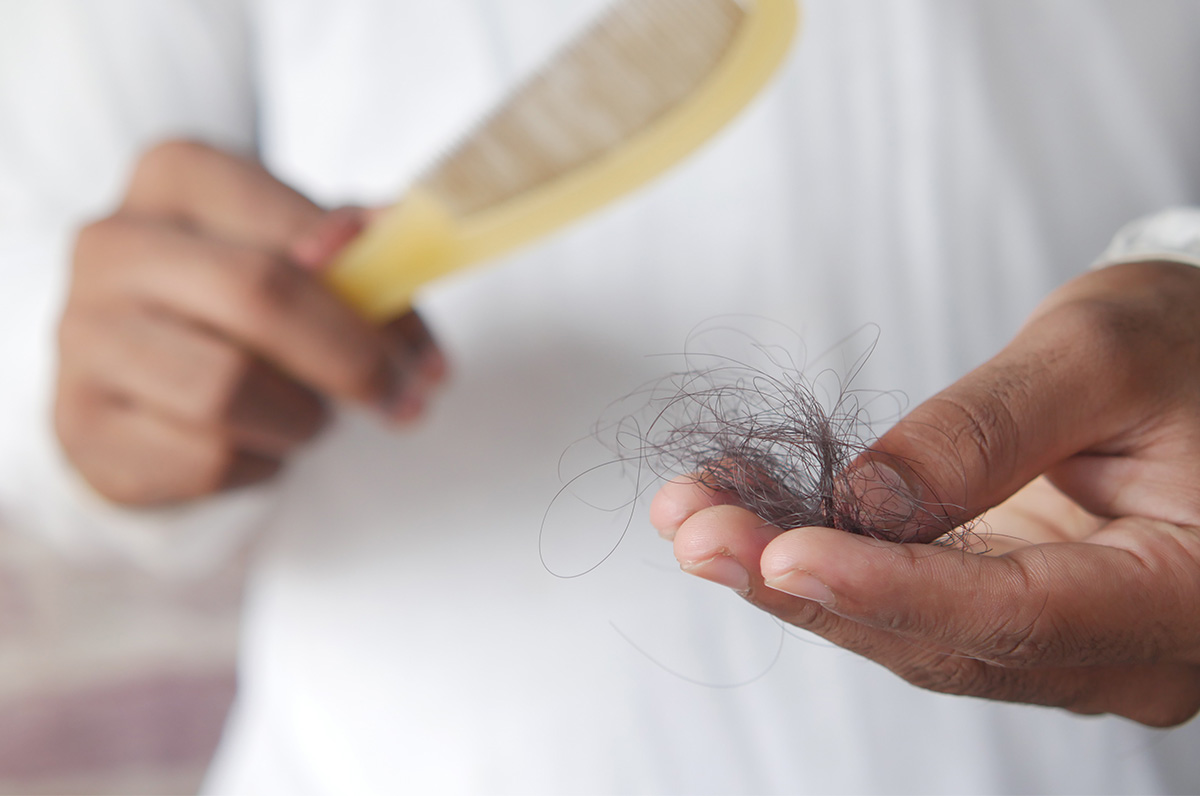 Alopecia-blog-header- Spotlighting Alopecia